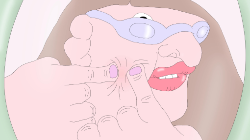 PIMPLE1.jpeg